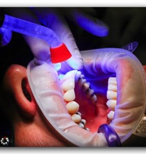 clínica de dentistas en Zaragoza